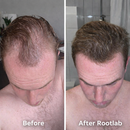 Give Your Hair a Fuller, Healthier Look with ROOTLAB