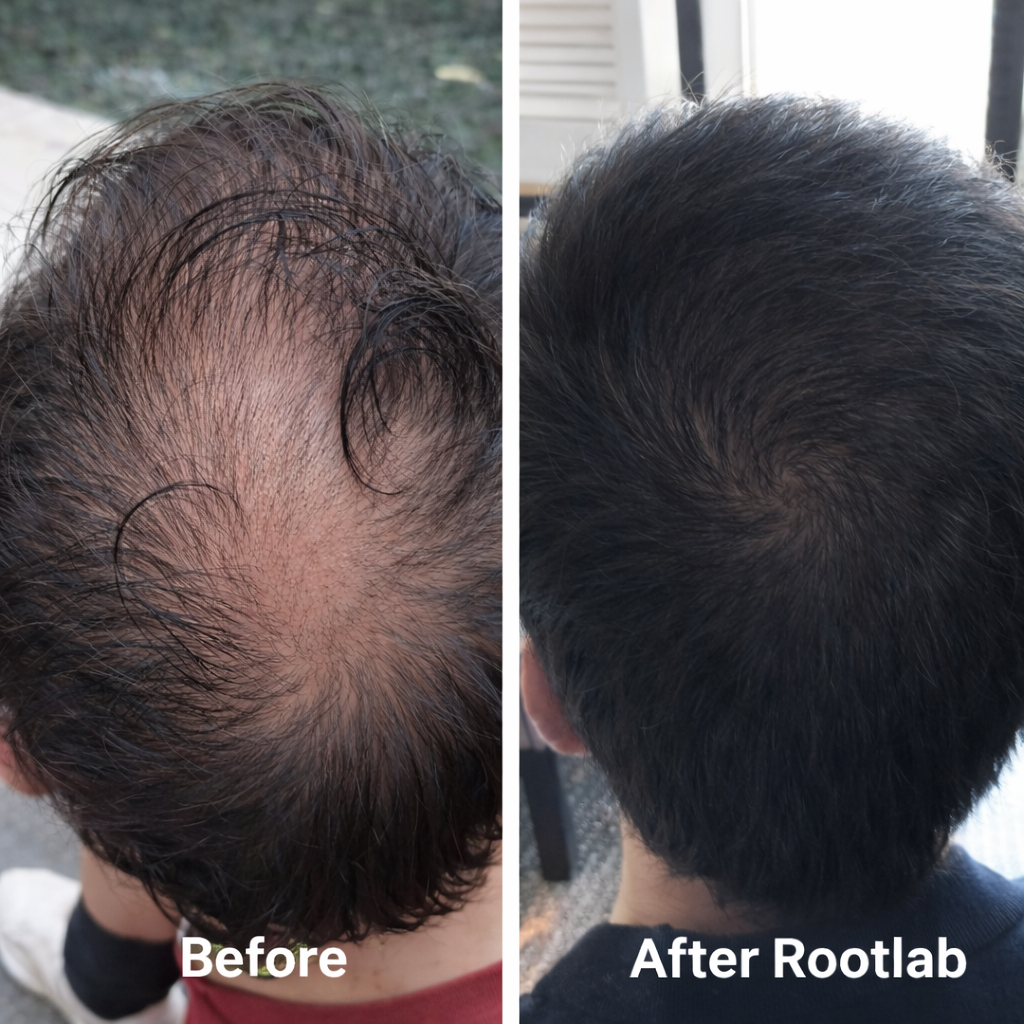 Give Your Hair a Fuller, Healthier Look with ROOTLAB